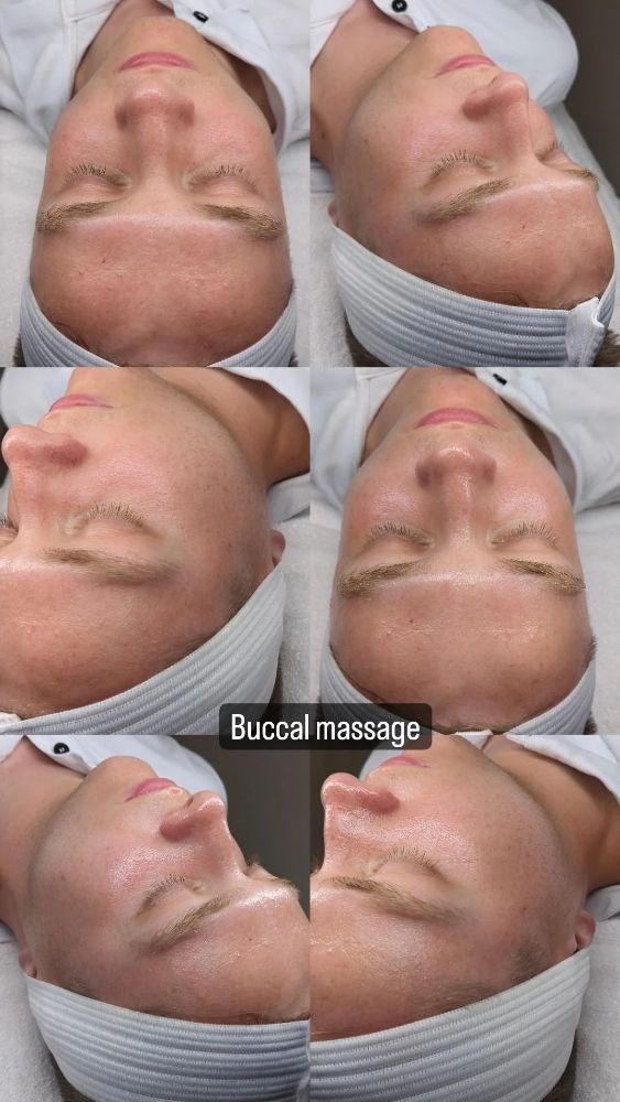 Buccal Massage Before After Photos